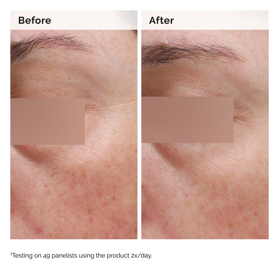 Niacinamide 5% Face and Body Emulsion - US 8923