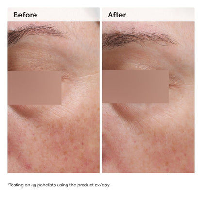 Niacinamide 5% Face and Body Emulsion - US 8923
