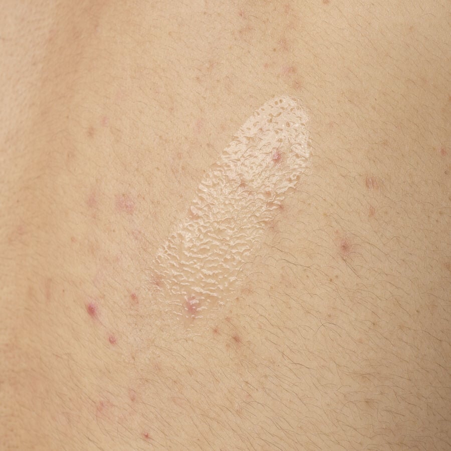 Salicylic Acid 0.5% Body Serum - US 9985