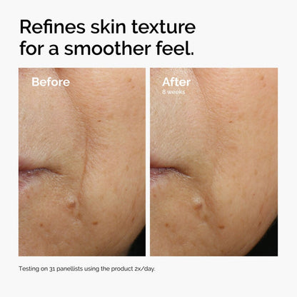 Caffeine 3% + Escin 1% Face Serum - US 4691
