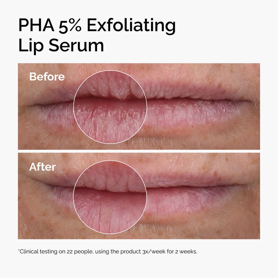 PHA 5% Exfoliating Lip Serum - US 6526