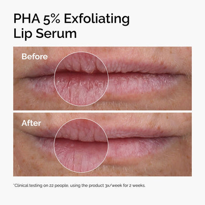PHA 5% Exfoliating Lip Serum - US 6526